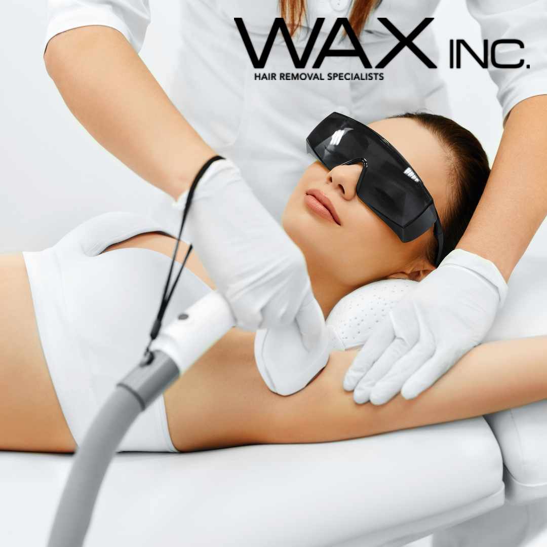 Laser Hair Removal Price List (from £35) - Wax Inc